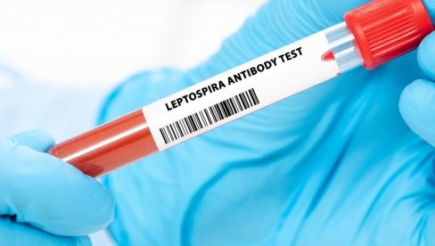 REGISTROVAN PRVI SLUČAJ LEPTOSPIROZE: Zarazna bolest potvrđena u Bijelom Polju REGISTROVAN PRVI SLUČAJ LEPTOSPIROZE: Zarazna bolest potvrđena u Bijelom Polju