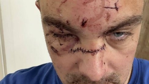 OTKRIVENO! Ovo je sudsko-medicinsko veštačenje utvrdilo povodom jezive tuče u kojoj su košarkaši Partizana teško povredili jednog muškarca OTKRIVENO! Ovo je sudsko-medicinsko veštačenje utvrdilo povodom jezive tuče u kojoj su košarkaši Partizana teško povredili jednog muškarca